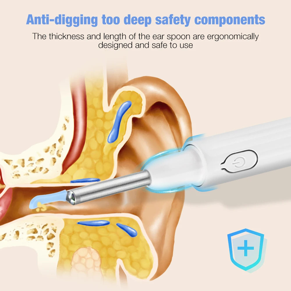 Wireless Smart Visual Ear Pick Removal Ear Wax Cleaner Spoon 3.5mm