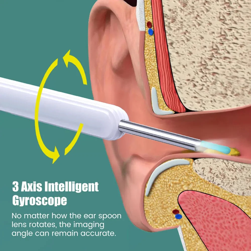 Wireless WiFi Ear Pick Otoscope Camera Borescope Luminous Ear Wax
