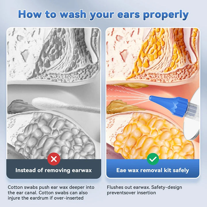 Ear Wax Removal Tool Manual Ear Irrigation Flushing System Safe And